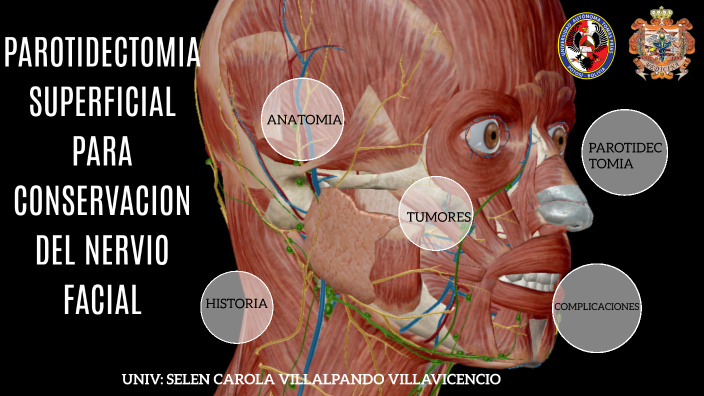 PAROTIDECTOMIA SUPERFICIAL by Carola Villalpando on Prezi