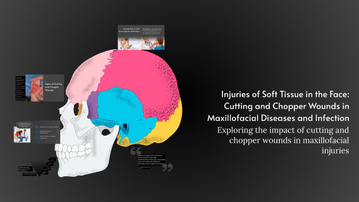 Injuries of Soft Tissue in the Face: Cutting and Chopper Wounds in ...