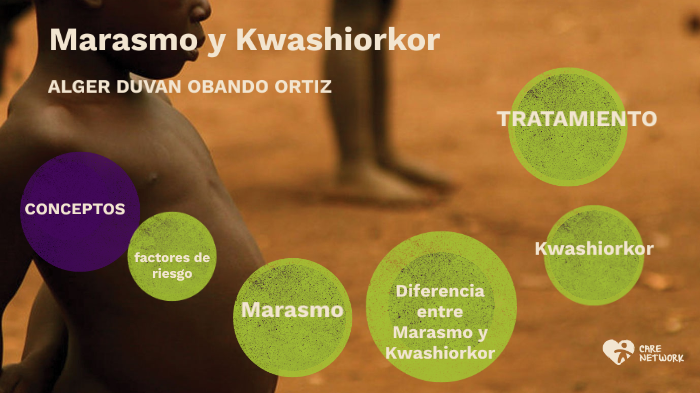 Marasmo Y Kwashiorkor By Alger Duvan Obando Ortiz On Prezi