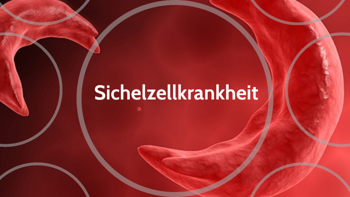 Sichelzellkrankheit by Michelle Brehm on Prezi