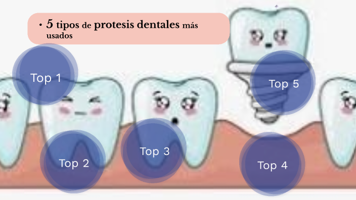 5 Tipos De Protesis Dentales Mas Utilizados By Karla Reyes On Prezi