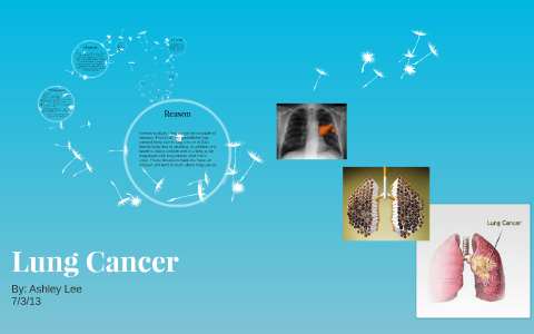 Lung Cancer by on Prezi