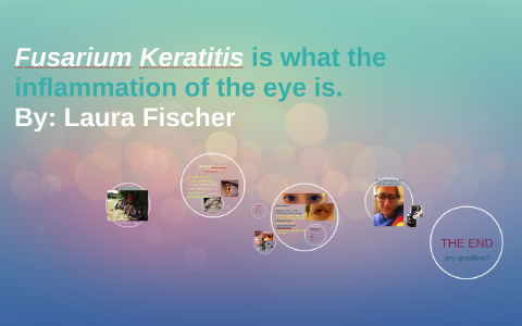 Laura Zerratits Fusarium Keratitis by Laura Fischer on Prezi