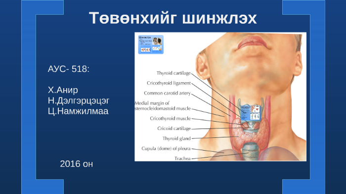 Төвөнхийг шинжлэх нь by ANIR KH on Prezi