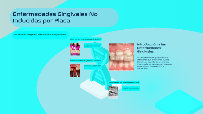 Enfermedades Gingivales No Inducidas por Placa by Andree Michel on Prezi