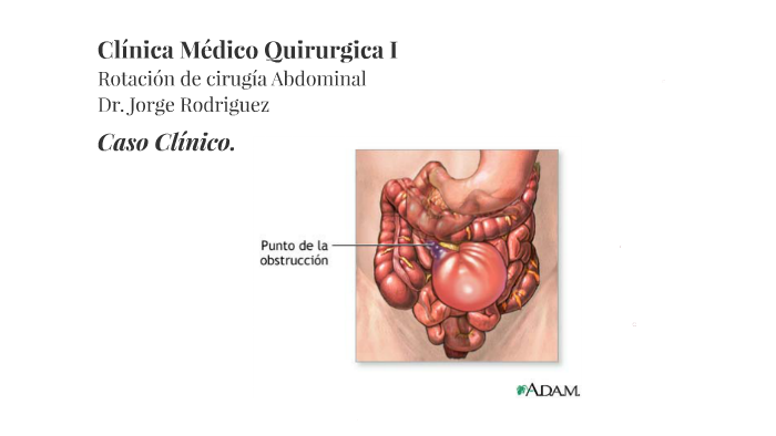 Caso Clinico Obstruccion intestinal by Jasson Arenas Gomez on Prezi