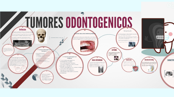 Tumores Odontogenicos Y Maxilares By Alejandro Izaguirre On Prezi