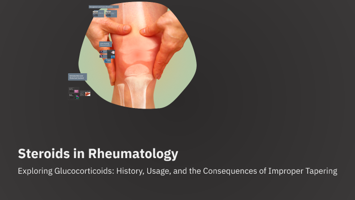 Steroids in Rheumatology by Alex Chop on Prezi