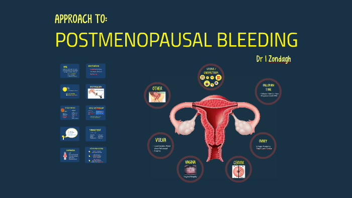 POSTMENOPAUSAL BLEEDING By Inge Zondagh On Prezi