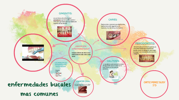 Enfermedades Bucales Mas Comunes By Susy Ortiz 7909