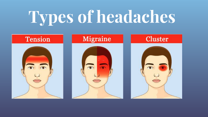 Types of headaches by Jurij Flat