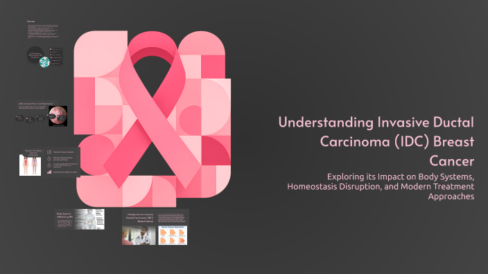 Idca Cancer Understanding Invasive Ductal Carcinoma (IDC) Breast Cancer by Leslie ...