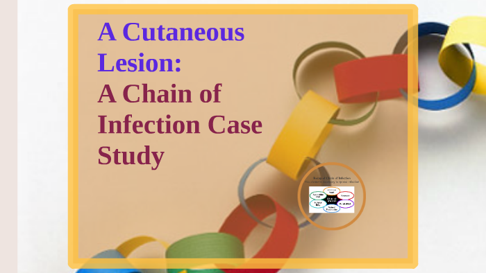 Cutaneous anthrax symptoms image