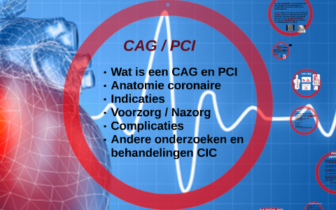 CAG / PCI by Ramona de Putter-Nelis on Prezi