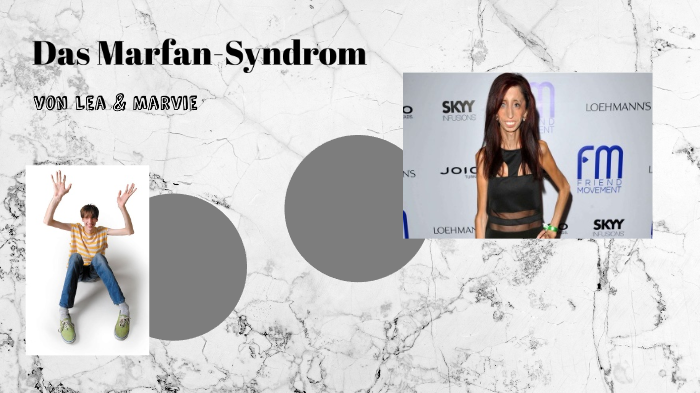 Das Marfan Syndrom By Marvie Kalteich On Prezi das-marfan-syndrom-by-marvie-kalteich-on-prezi