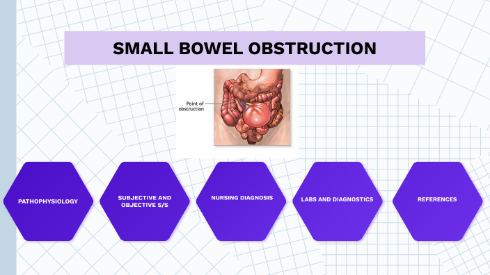 SMALL BOWEL OBSTRUCTION by Sandra Wambui on Prezi