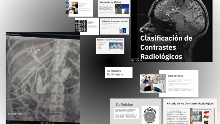 Contraste Radiológicos y su Clasificación by osnayder Daza A. on Prezi