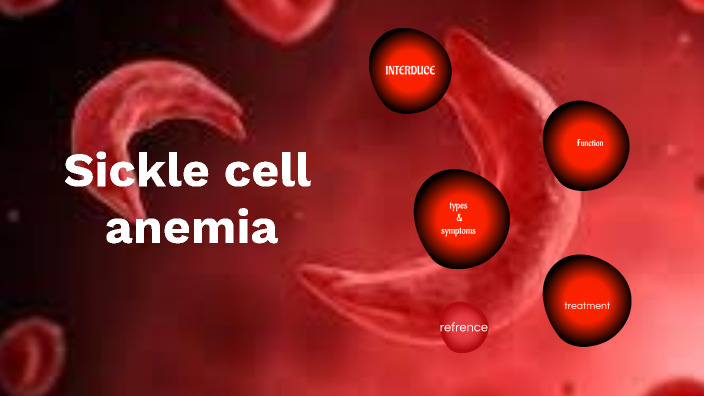 Sickle cell anemia by parva amini on Prezi