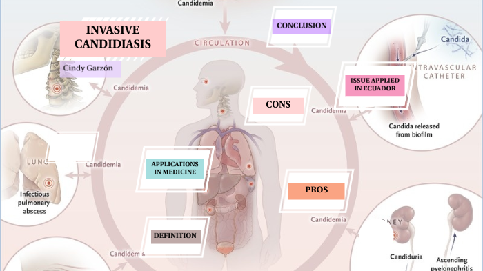 Invasive on sale candidiasis symptoms