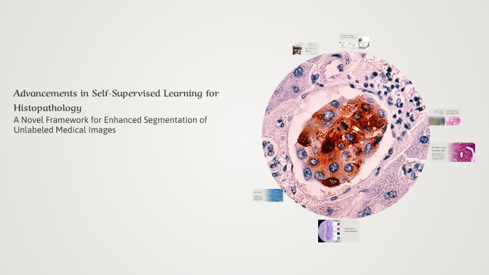 Advancements in Self-Supervised Learning for Histopathology by ...