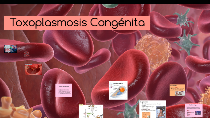 Toxoplasmosis Congenita By Nicolé Vargas On Prezi 3026