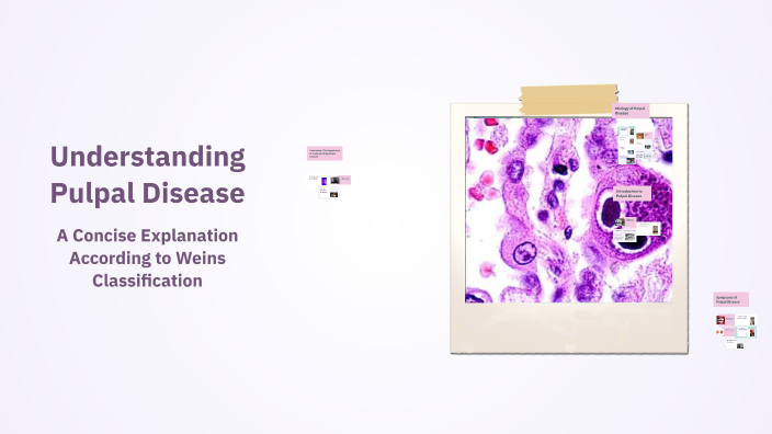 Pulpak Patch Understanding Pulpal Disease by Kate Palma on Prezi