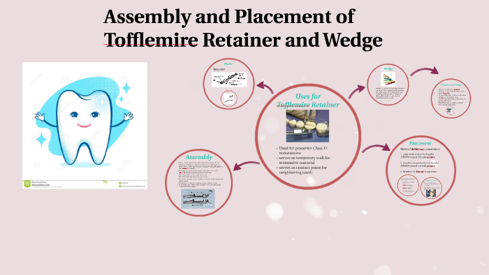 Tofflemire Retainer By Jeni Rae Stacey