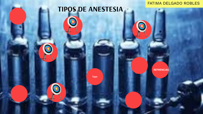 Tipo De Anestesia By Fatima Delgado Robles On Prezi