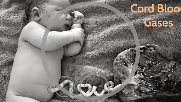 Cord Blood Gases By Sarah Robertson On Prezi cord-blood-gases-by-sarah-robertson-on-prezi