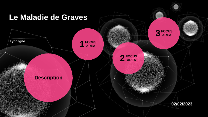 Grace Basedow Le Maladie de Graves-Basedow by lynn igne on Prezi