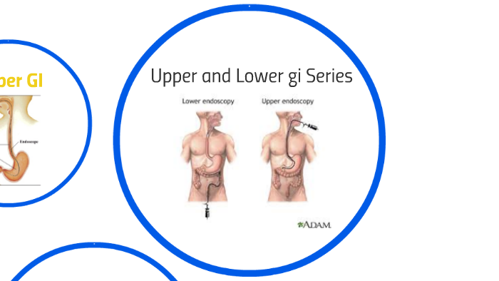 upper-and-lower-gi-series-by-monica-rosdhal