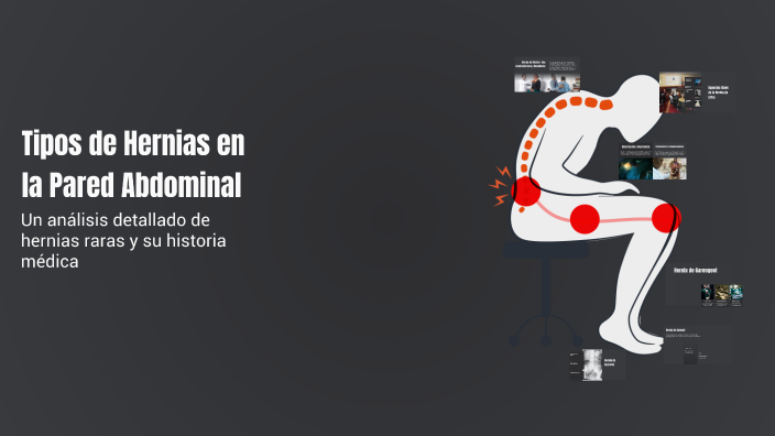 Tipos de Hernias en la Pared Abdominal by grace villarroel on Prezi