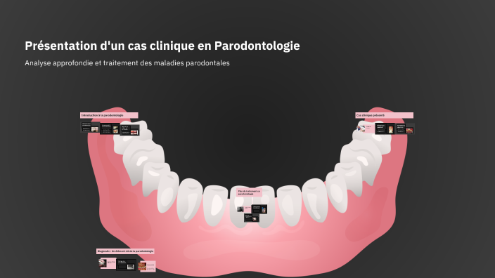 Présentation d'un cas clinique en endodontie by ir az on Prezi