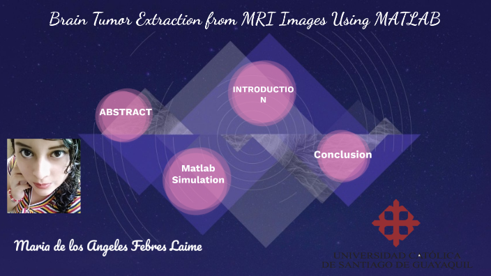Brain Tumor Extraction from MRI Images Using MATLAB by maria febres on ...