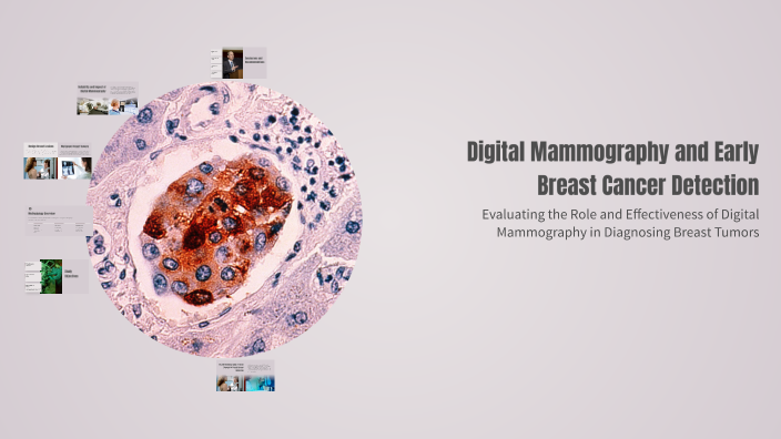 Digital Mammography and Early Breast Cancer Detection by the. boss on Prezi