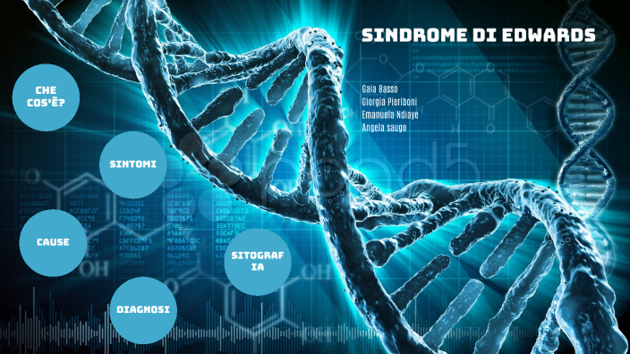 Sindrome Di Edwards By Emanuela Ndiaye On Prezi 9142