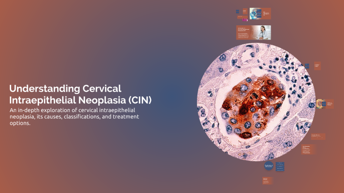 Understanding Cervical Intraepithelial Neoplasia (CIN) by Hu Da on Prezi