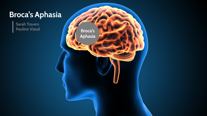 Broca's aphasia by Pauline Viaud on Prezi