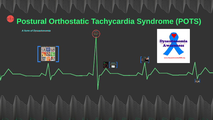 Postural Orthostatic Tachycardia Syndrome by Olivia Kropp on Prezi