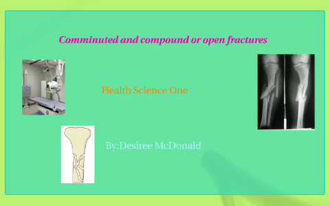 comminuted and compound or open fracture by Desiree mcDonald on Prezi