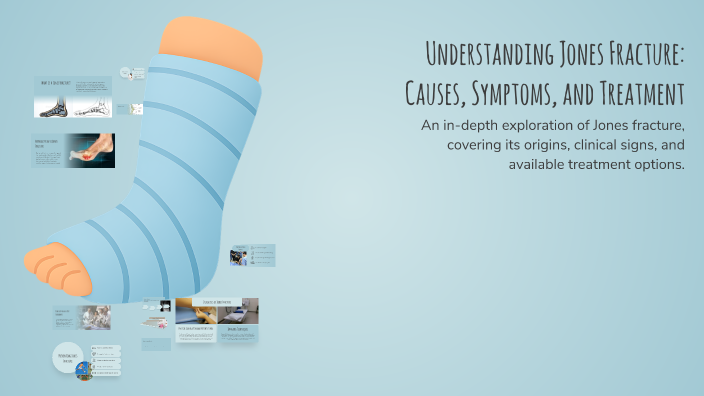 Understanding Jones Fracture: Causes, Symptoms, and Treatment by Jeff W ...