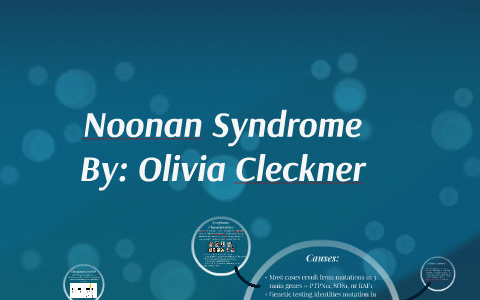 Noonan Disease by Olivia Cleckner on Prezi