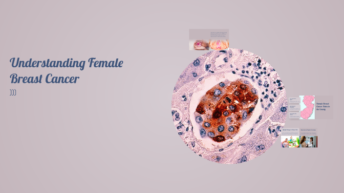 Understanding Female Breast Cancer by Yasmeen AliAlAbed on Prezi