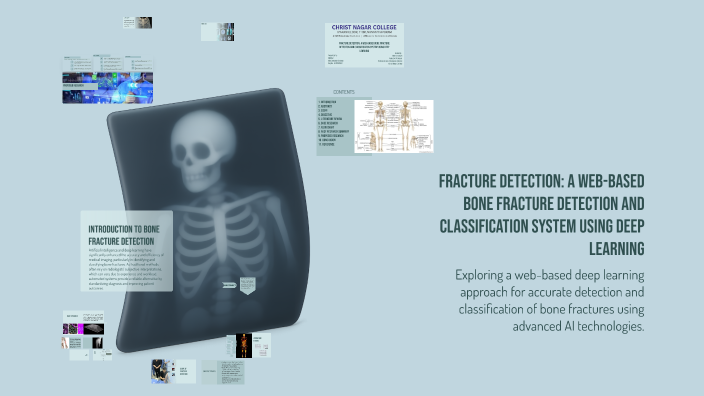 Fracture Detection: A Web-Based Bone Fracture Detection and ...