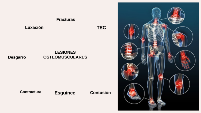 Lesiones Osteomusculares By VALENTINA MARMOL On Prezi