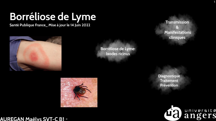 icd 10 lyme borreliose