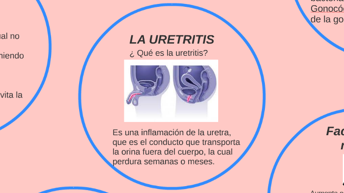 qué y uretritis no gonocócicas qué y uretritis no gonocócicas