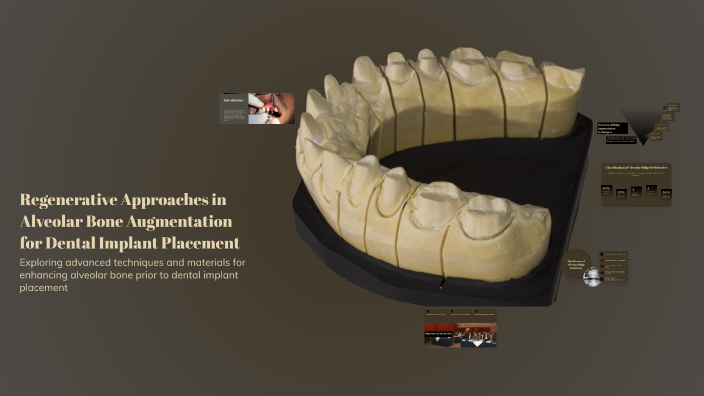 Regenerative Approaches in Alveolar Bone Augmentation for Dental ...