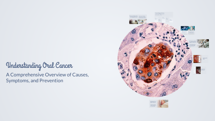 Understanding Oral Cancer by J Jenophin on Prezi