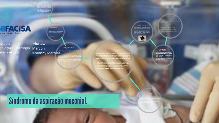 SINDROME DE ASPIRACÃO DE MECONIO by Simonny Drummond on Prezi